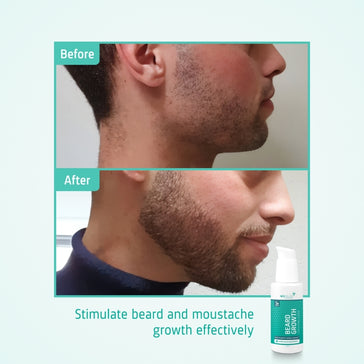Neofollics Bartserum (7% Neoxyl) Neofollics Bartserum (7% Neoxyl) - Hairgivers