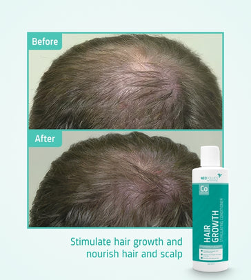 Neofollics Conditioner Neofollics Conditioner - Hairgivers