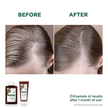 Klorane Anti-Haarausfall Shampoo + Conditioner Klorane Anti-Haarausfall Shampoo + Conditioner - Hairgivers