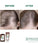 Klorane Anti-Haarausfall Shampoo + Conditioner - Hairgivers