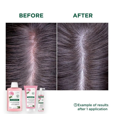 Klorane Behandlung für empfindliche Kopfhaut Klorane Behandlung für empfindliche Kopfhaut - Hairgivers