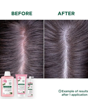 Klorane Behandlung für empfindliche Kopfhaut Klorane Behandlung für empfindliche Kopfhaut - Hairgivers