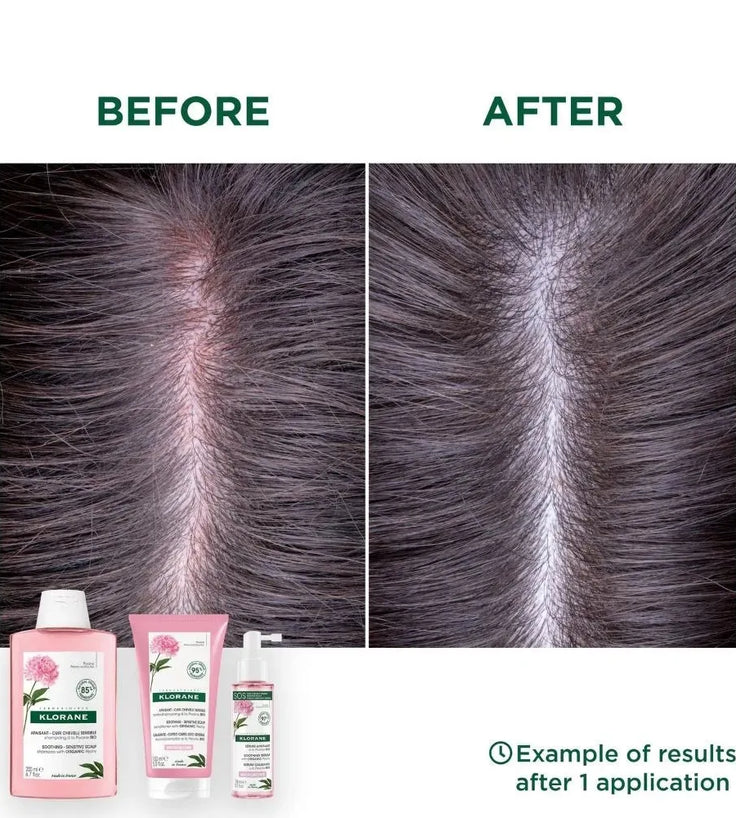 Klorane Behandlung für empfindliche Kopfhaut - Hairgivers