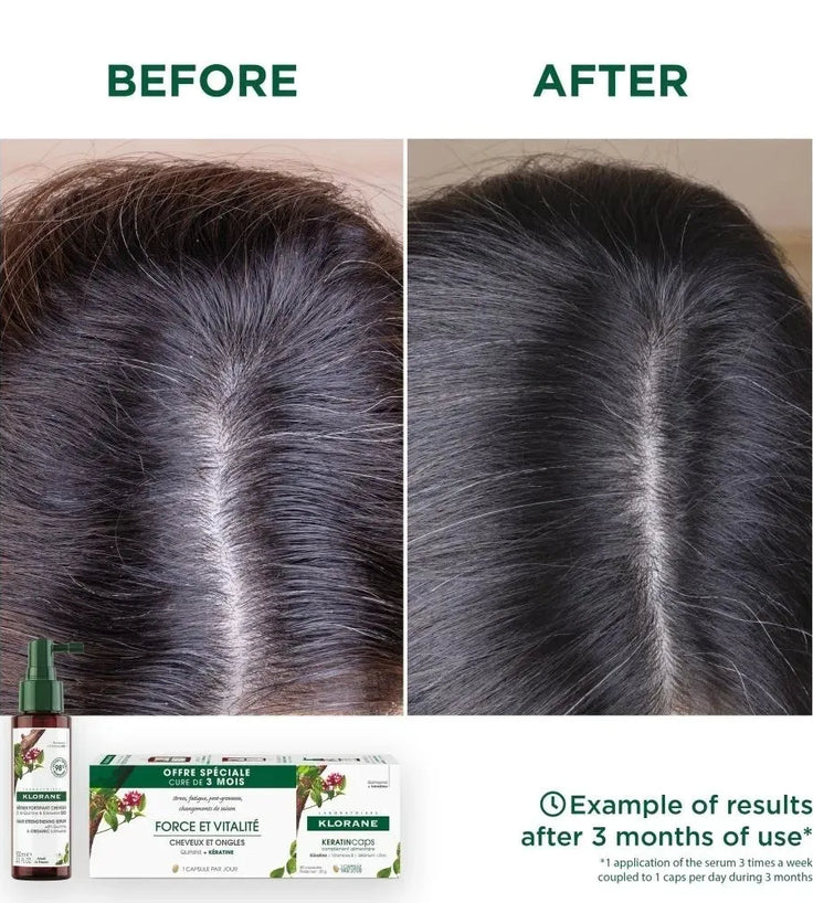 Klorane Serum gegen Haarausfall Chinin/Edelweiss (100 ml) - Hairgivers
