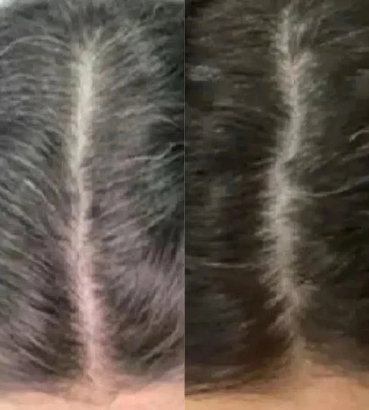 Neofollics Anti-Grau Haartabletten (3-Pack) - Hairgivers