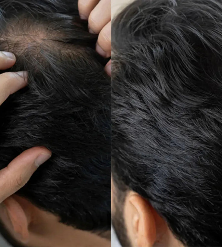 Panthrix Haarwuchs Aktivator (Redensyl) Serum - Hairgivers
