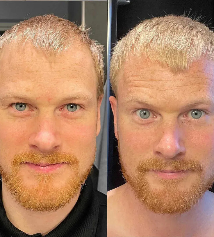Scandinavian Biolabs Conditioner für Männer (250 ml) - Hairgivers