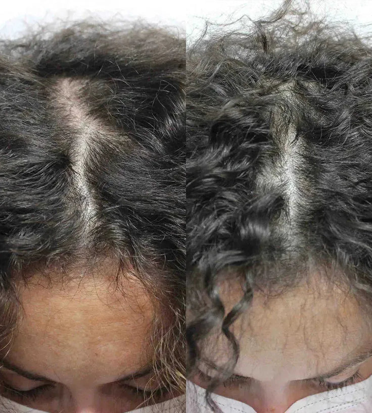 Scandinavian Biolabs Haarwuchsbehandlung (Frau) - Hairgivers