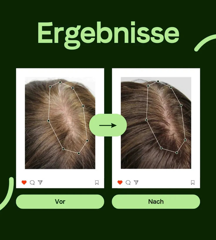 Scandinavian Biolabs Serum für Männer (100 ml) - Hairgivers