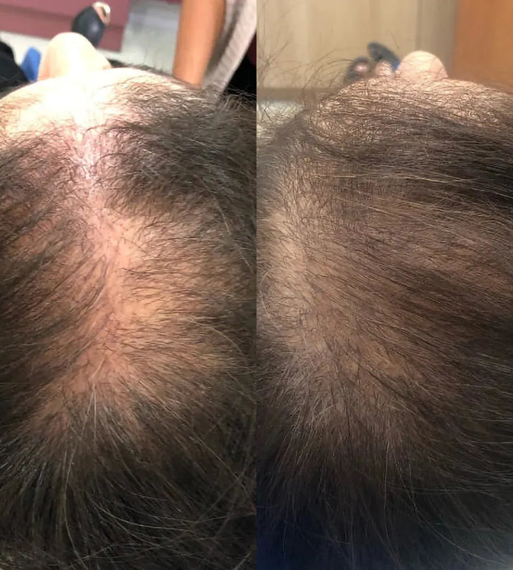 Spectral.CSF Haarserum - Hairgivers