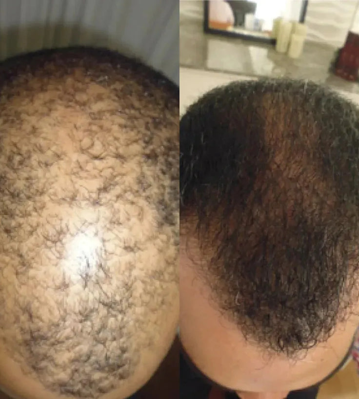 Spectral DNC-N (Nanoxidil) Haarserum - Hairgivers