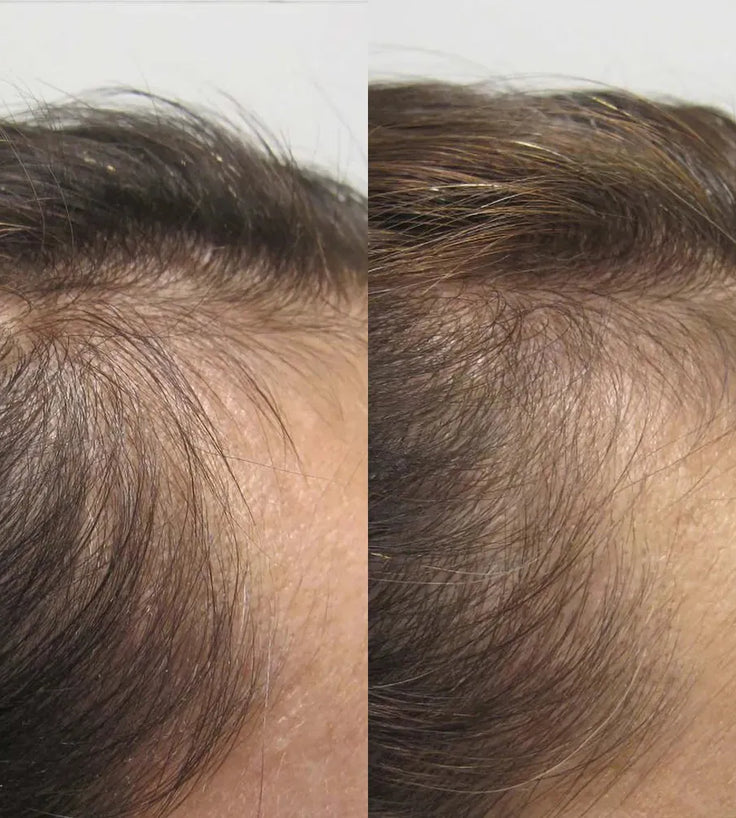 Viviscal Haarwachstums-Tabletten für Frauen (1 Monat) - Hairgivers