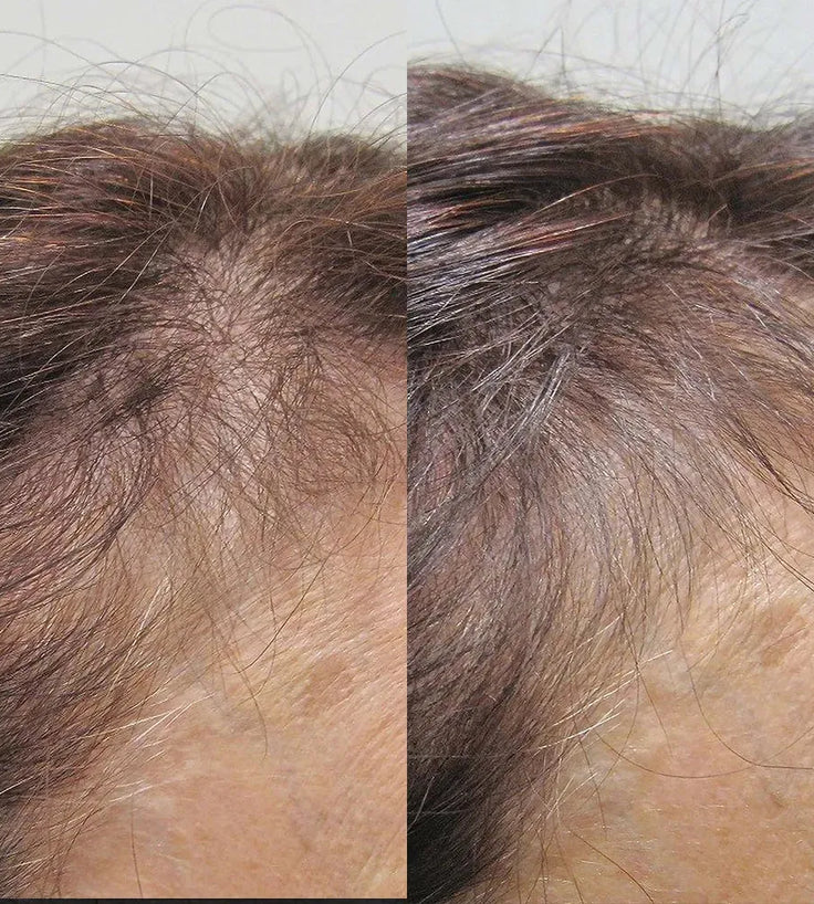 Viviscal Haarwachstums-Tabletten für Frauen (3 Monate) - Hairgivers