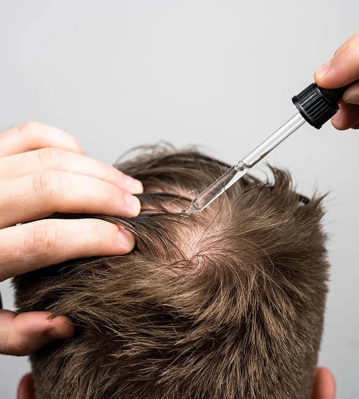 Scandinavian Biolabs Serum für Männer (100 ml) - Hairgivers