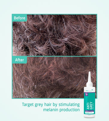 Neofollics Anti-Grau Haarserum Neofollics Anti-Grau Haarserum - Hairgivers