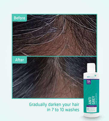 Neofollics Anti-Grau Shampoo Neofollics Anti-Grau Shampoo