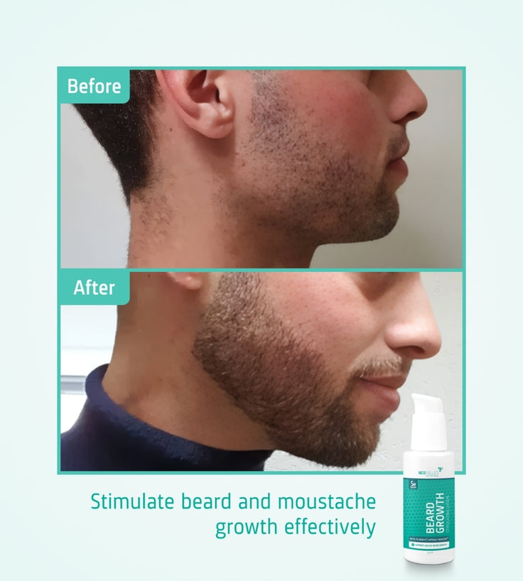 Neofollics Bartserum 3-Pack (7% Neoxyl)