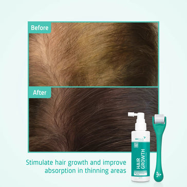 Neofollics Haarwuchs Kit - Hairgivers