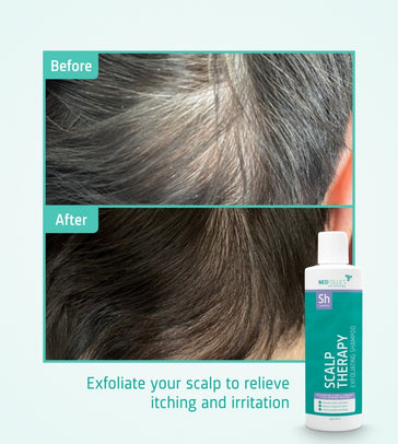 Neofollics Peeling Shampoo Neofollics Peeling Shampoo - Hairgivers