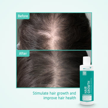 Neofollics Shampoo gegen Haarausfall (250 ml) - Hairgivers