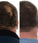 Foligain Shampoo gegen Haarausfall für Männer (236 ml) - Hairgivers