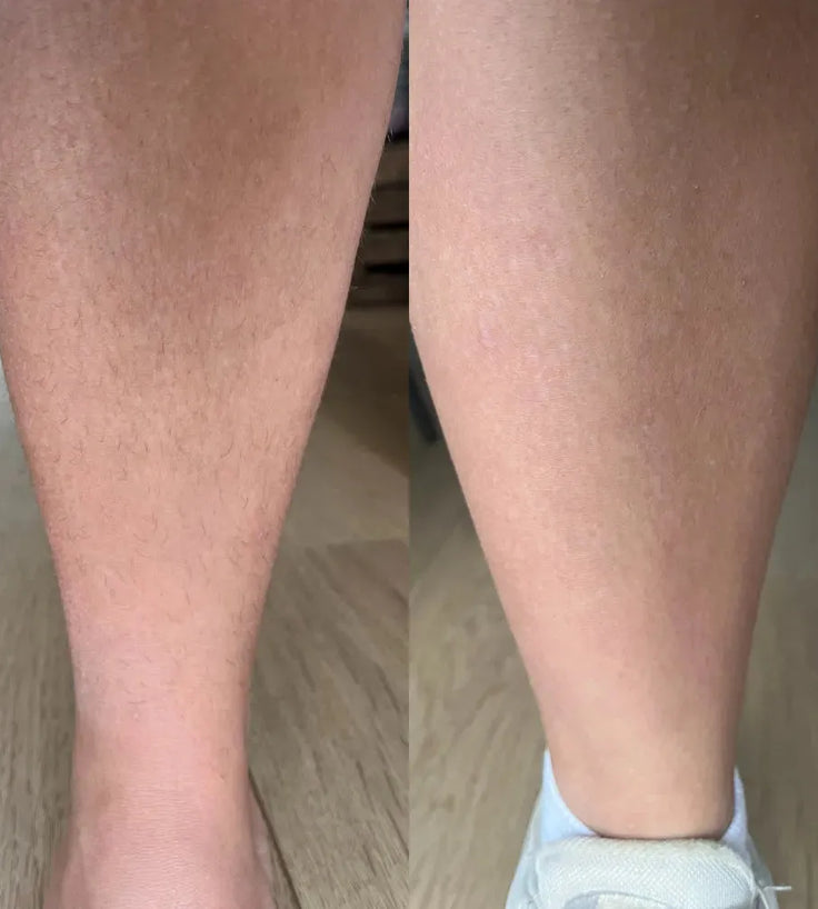 Keramene Body Hair Minimizer - Hairgivers