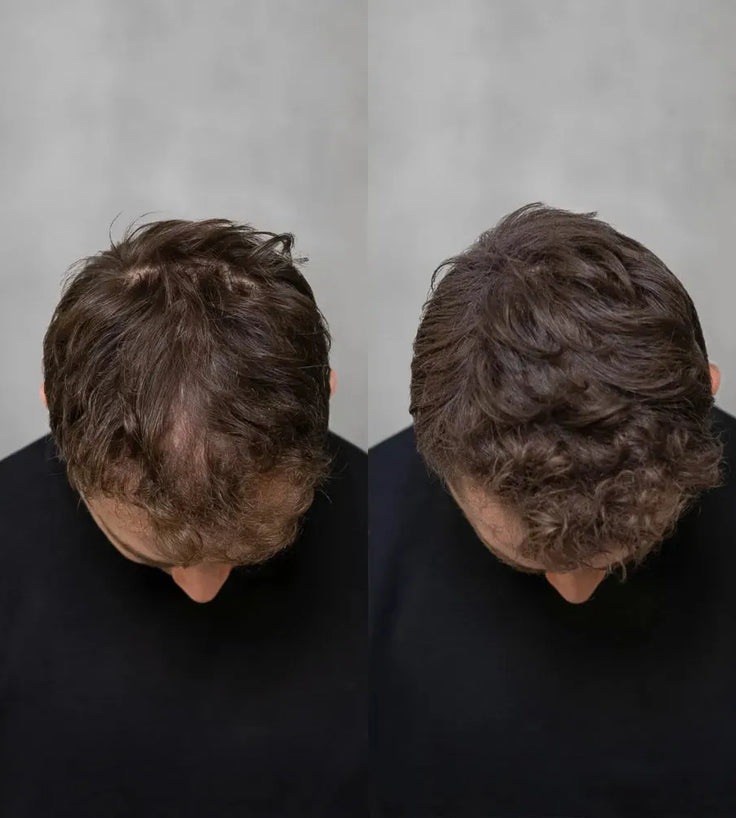 Keratain Streuhaar - Dunkelblond (25 gr) - Hairgivers
