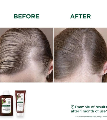 Klorane Anti-Haarausfall Shampoo + Conditioner - Hairgivers