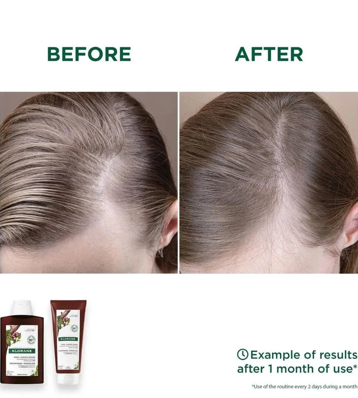 Klorane Anti-Haarausfall Shampoo + Conditioner - Hairgivers