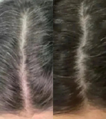 Neofollics Anti-Grau Haartabletten (3-Pack) - Hairgivers