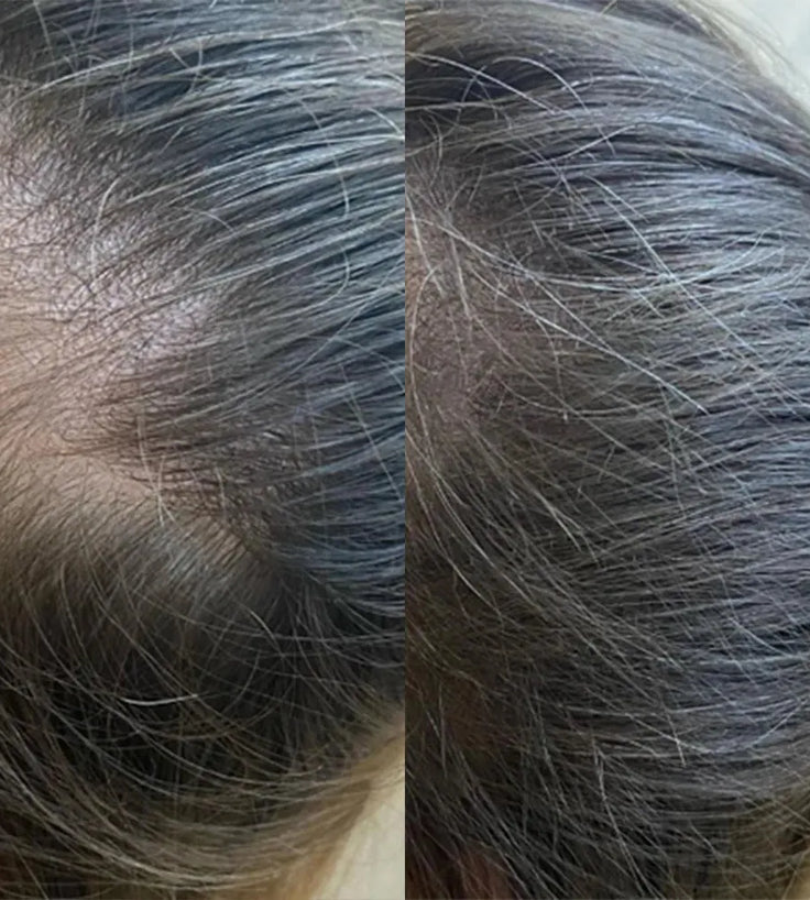 Panthrix Haarwuchs Aktivator (Redensyl) Serum - Hairgivers