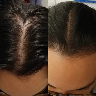 Scandinavian Biolabs Shampoo + Conditioner für Frauen Kombi-Packung - Hairgivers