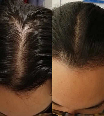 Scandinavian Biolabs Shampoo + Conditioner für Frauen Kombi-Packung - Hairgivers
