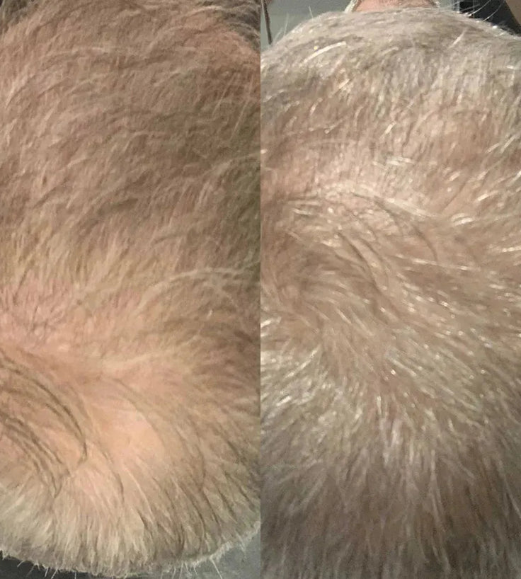 Scandinavian Biolabs Shampoo + Conditioner für Männer Kombi-Packung - Hairgivers