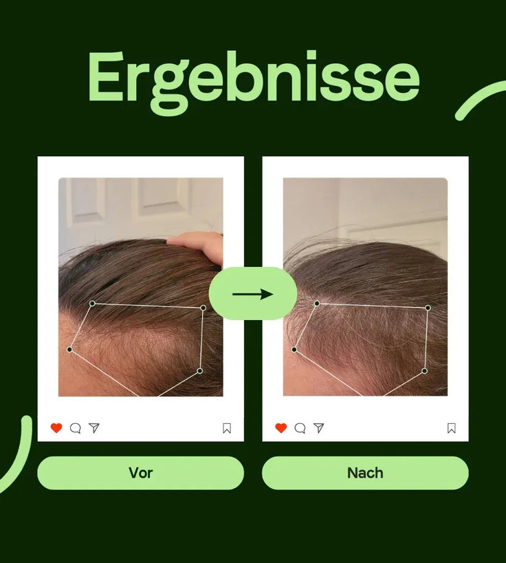 Scandinavian Biolabs Shampoo für Männer (250 ml) - Hairgivers